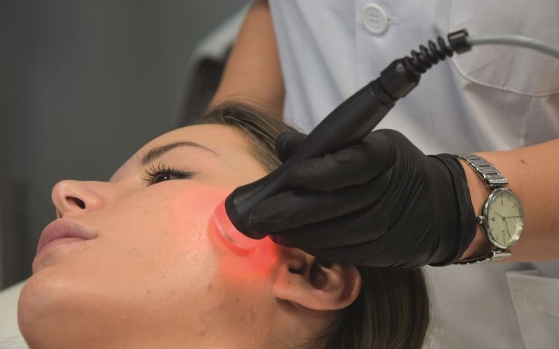 spa skin radiofrequenza